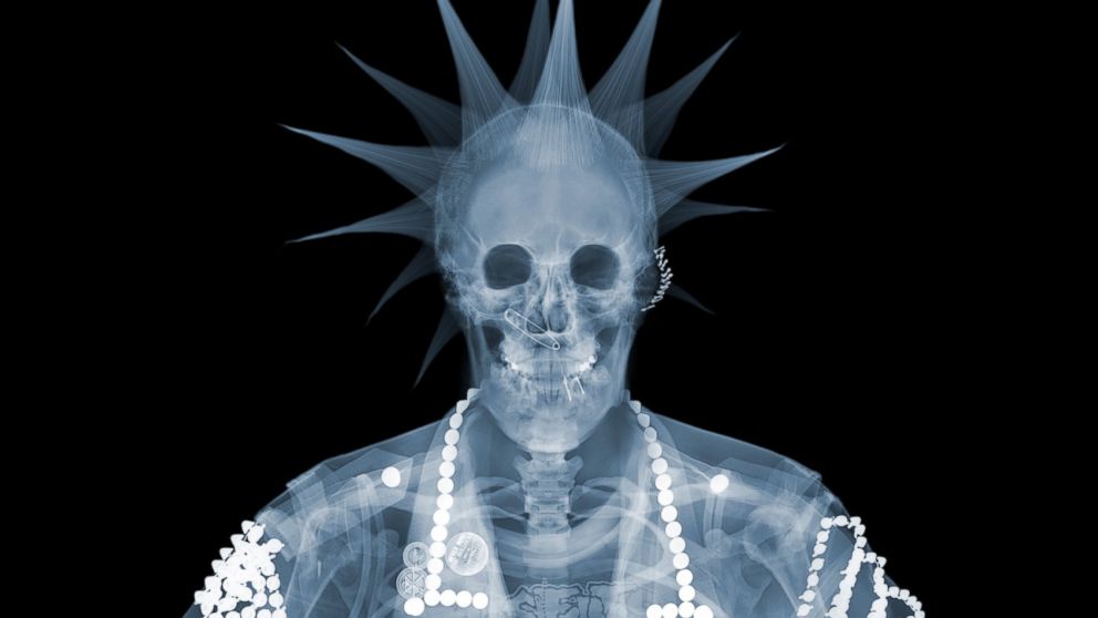 Nick Veasey